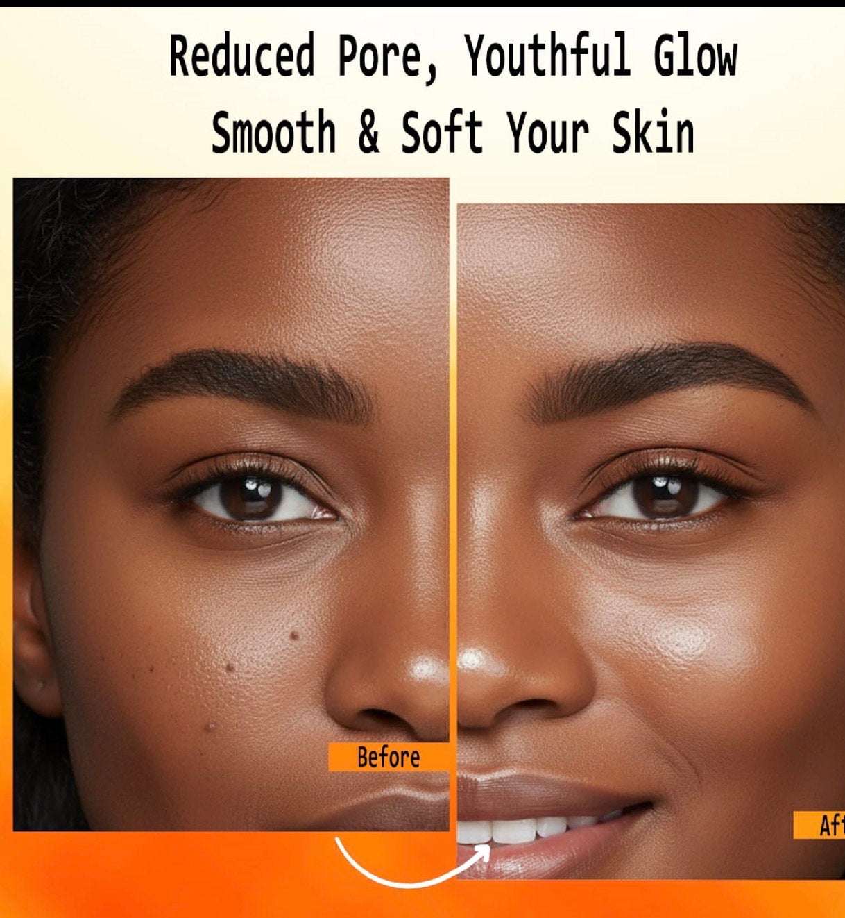 Anume Naturals Kojic Acid and Turmeric cleansing pads before and after showing reduced pores and radiant, smooth skin glow